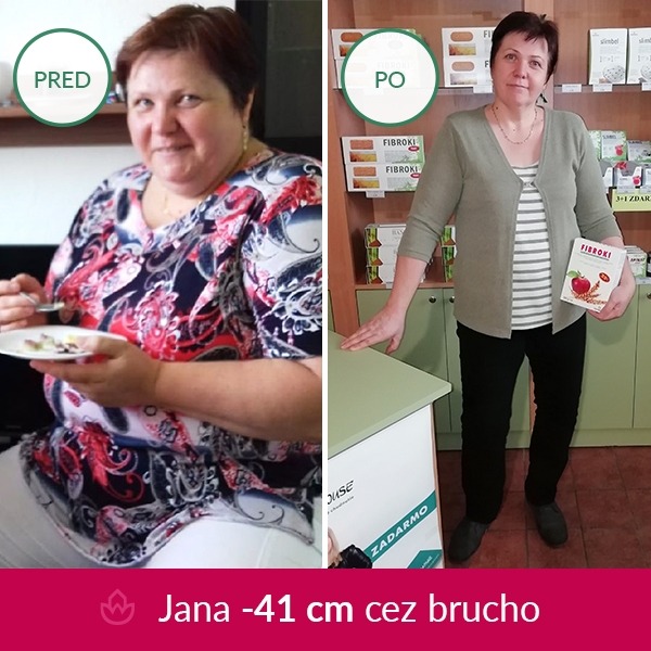 Jana Baumgartnerová — premena pred a po
